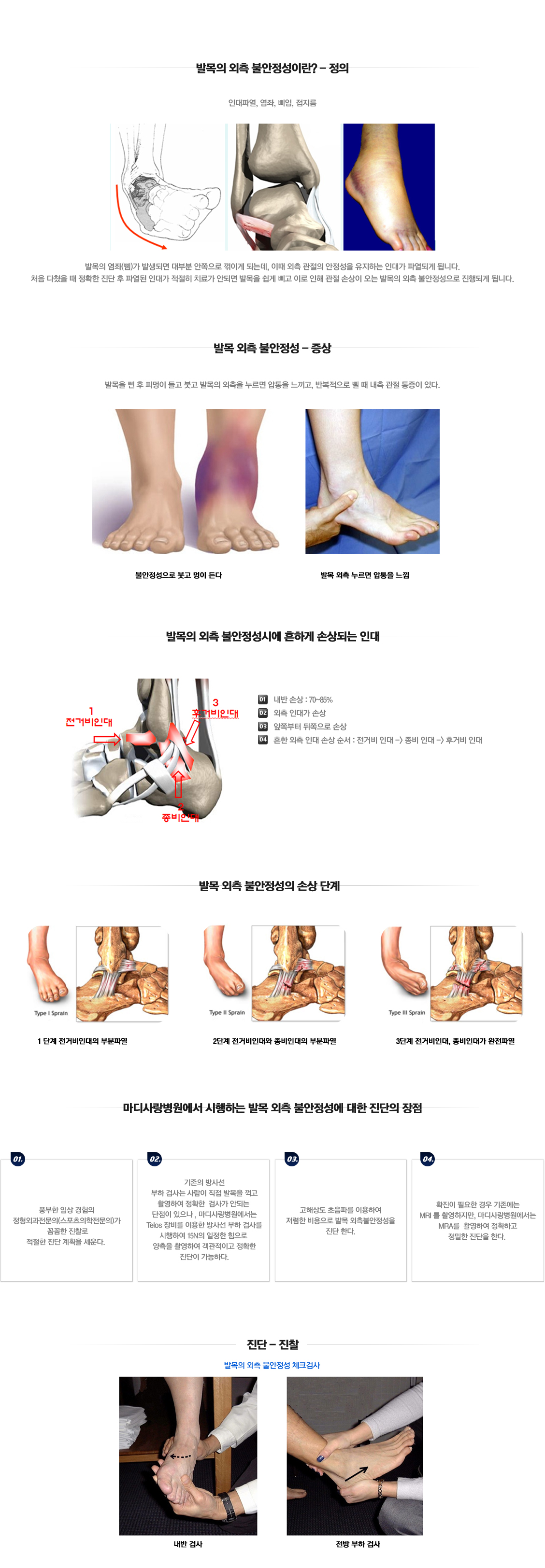 외측 불안정성