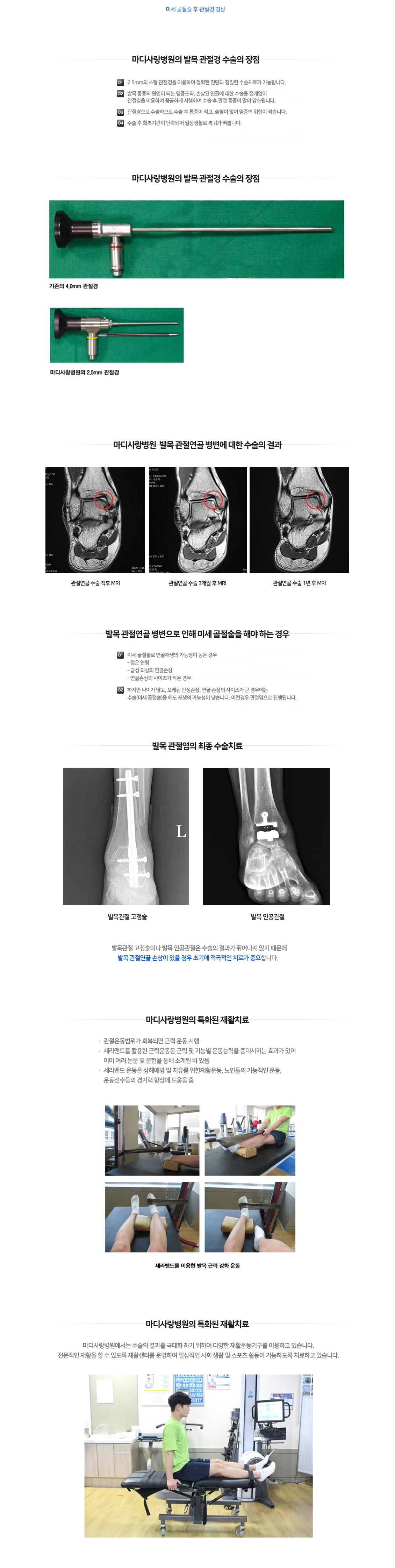 발목 증상별 진단