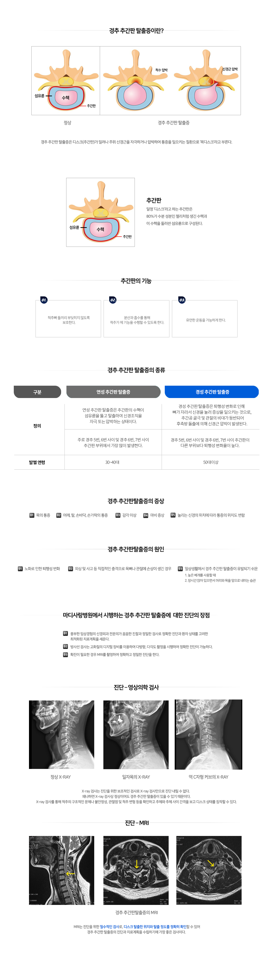 경추추간판탈출증