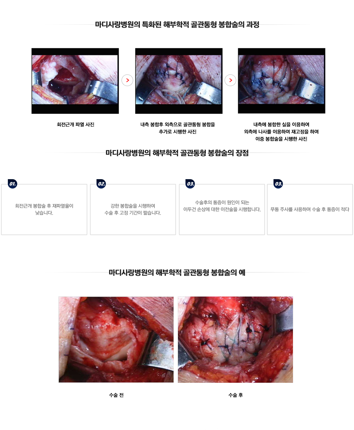 충돌증후군