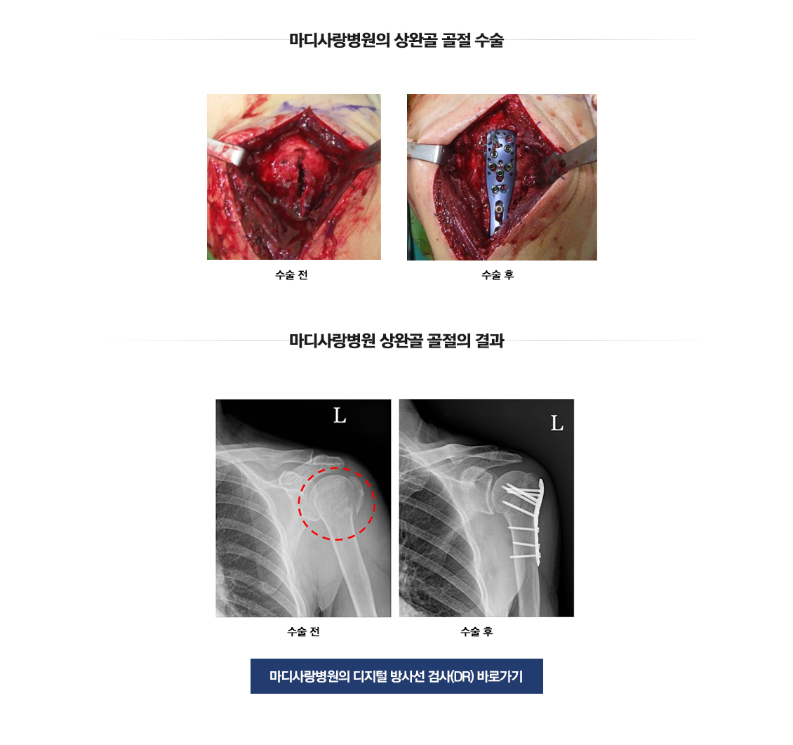 충돌증후군